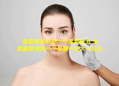 脂肪填充打完一个星期好丑 全脸脂肪填充一个星期一边大一边小
